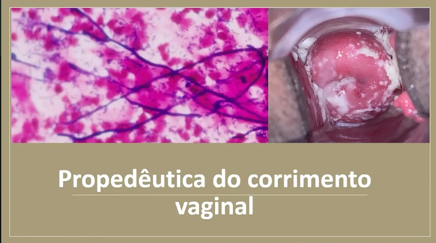 Prévia da Aula Experimental